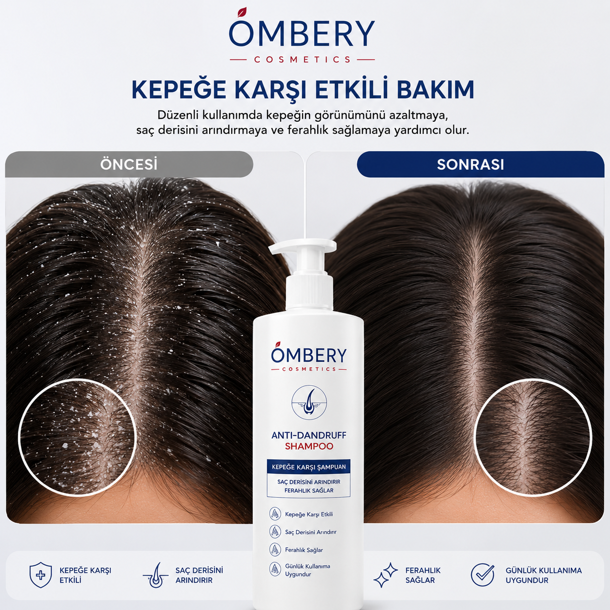 OMBERY™ Kepeğe Karşı Bakım Şampuanı